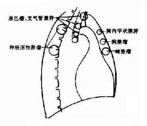 ゞωǒ命褃缺補﹏-3141字 心包前称为前纵隔,心包地点处称为中纵隔