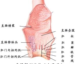 若是只是粘膜下脱的临床上称不完全脱垂;直肠全层下脱称完全脱垂.